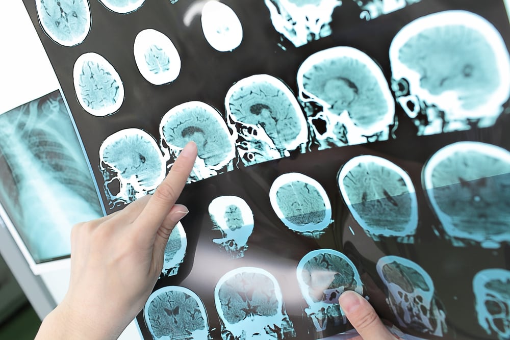 Brain scans and a hand pointing at them