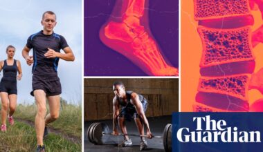 ‘I spent a week crying. I’ve never had an injury in my life!’ Why do so many fitness fans end up needing surgery? | Health & wellbeing