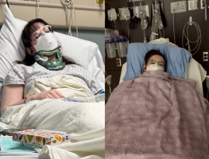 Two side-by-side photos of a young woman in a hospital bed