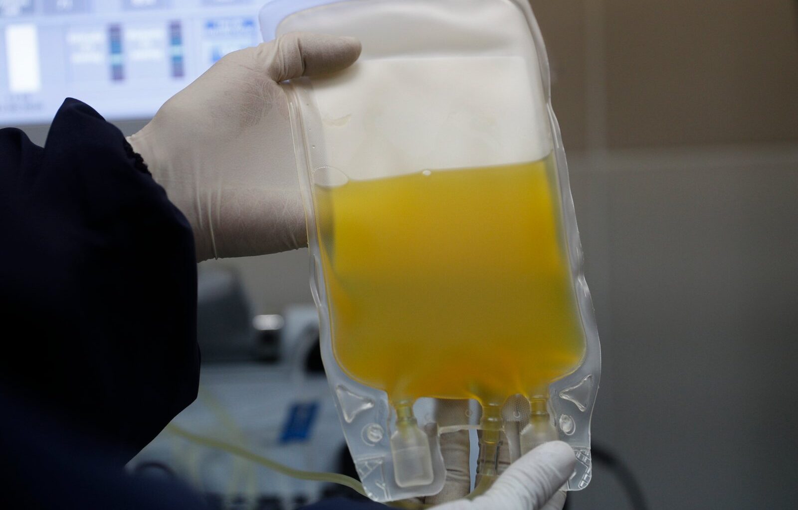 Scrutinized private clinic pauses plasma collection across Canada – Winnipeg Free Press
