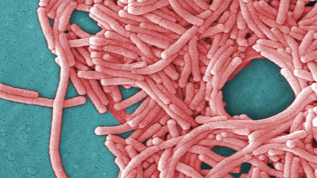 TTC cooling tower is source of legionnaire’s disease outbreak: Toronto Public Health