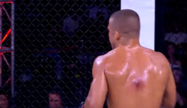 Fans React To ‘Disgusting’ Staph Infection, Slam CSAC For Approving Fight