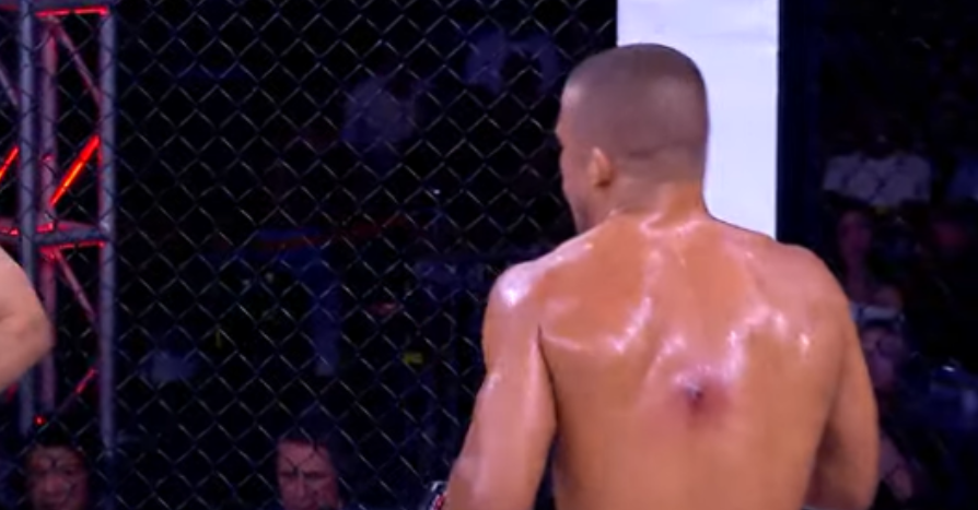 Fans React To ‘Disgusting’ Staph Infection, Slam CSAC For Approving Fight