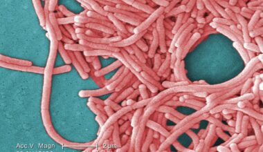 Outbreak of legionnaires’ disease being investigated near downtown core in Toronto