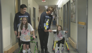 ‘Twin’ nurses help Barrie twin girls in lengthy rehab
