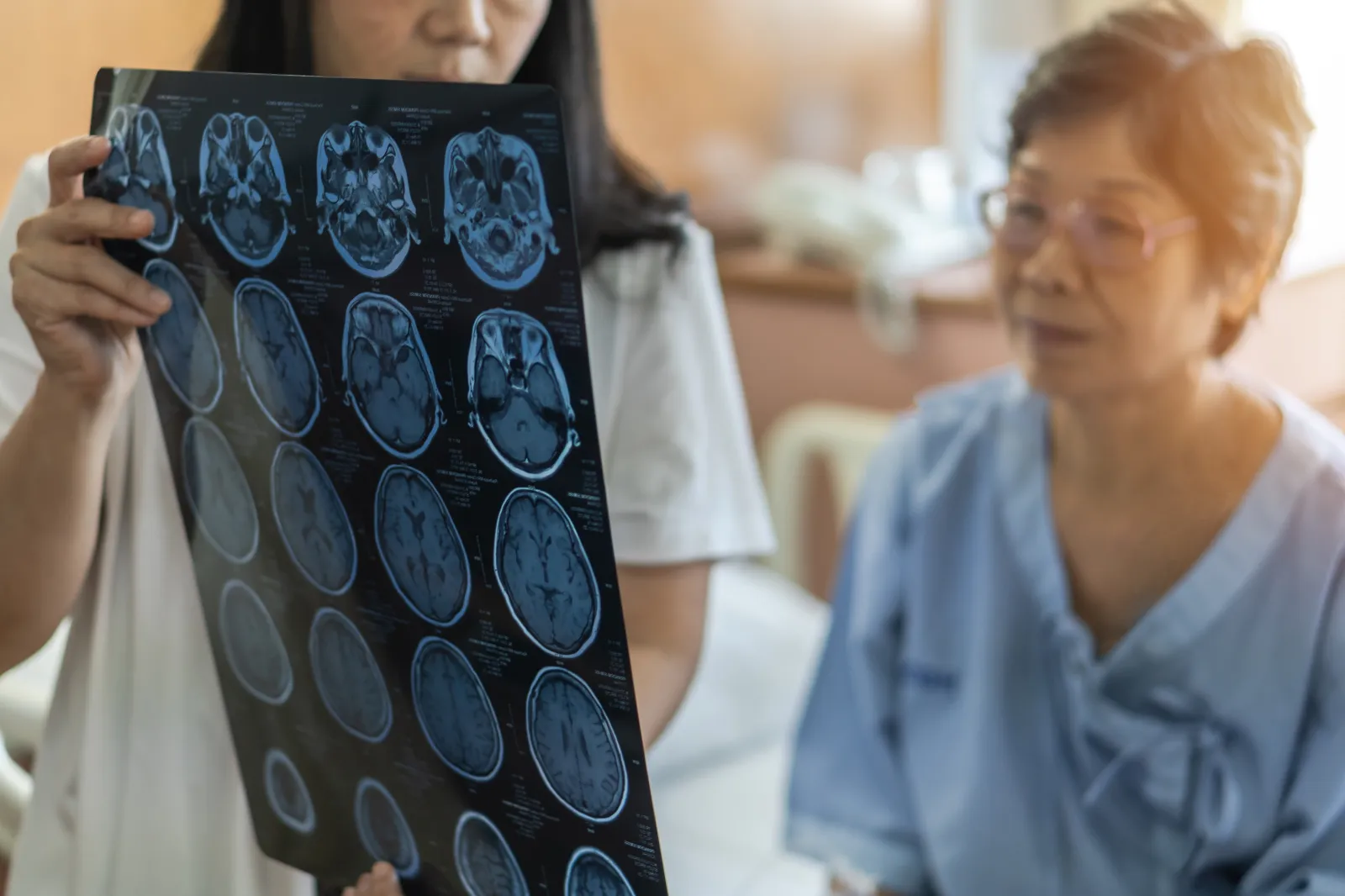 A stock image shows a doctor showing a senior patient a brain scan.