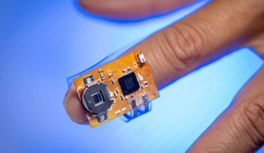 Researchers have developed a wearable sensor that continuously monitors Parkinson's disease medication levels through a patient's sweat.