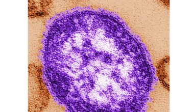 Measles exposure reported at Vaughan hospital
