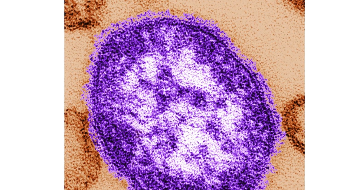Measles exposure reported at Vaughan hospital