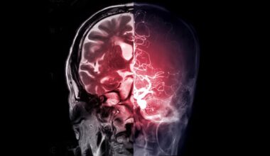 Diabetes Drug Used For More Than 60 Years Found to Unexpectedly Affect The Brain : ScienceAlert