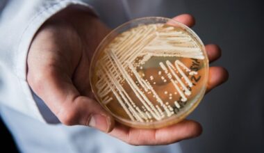 Candida auris: What to know about the fungus contaminating health spaces
