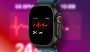 An Apple Watch performing an ECG.