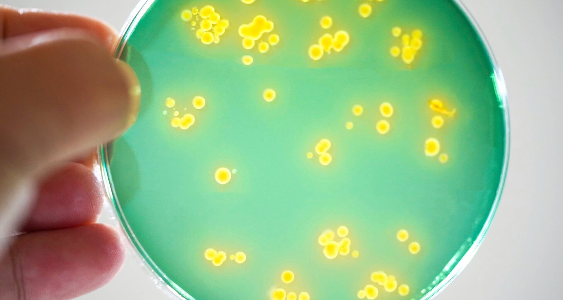 Vibrio bacteria being grown on a petri dish.