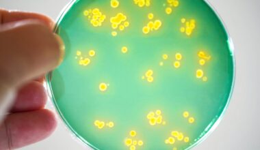 Vibrio bacteria being grown on a petri dish.