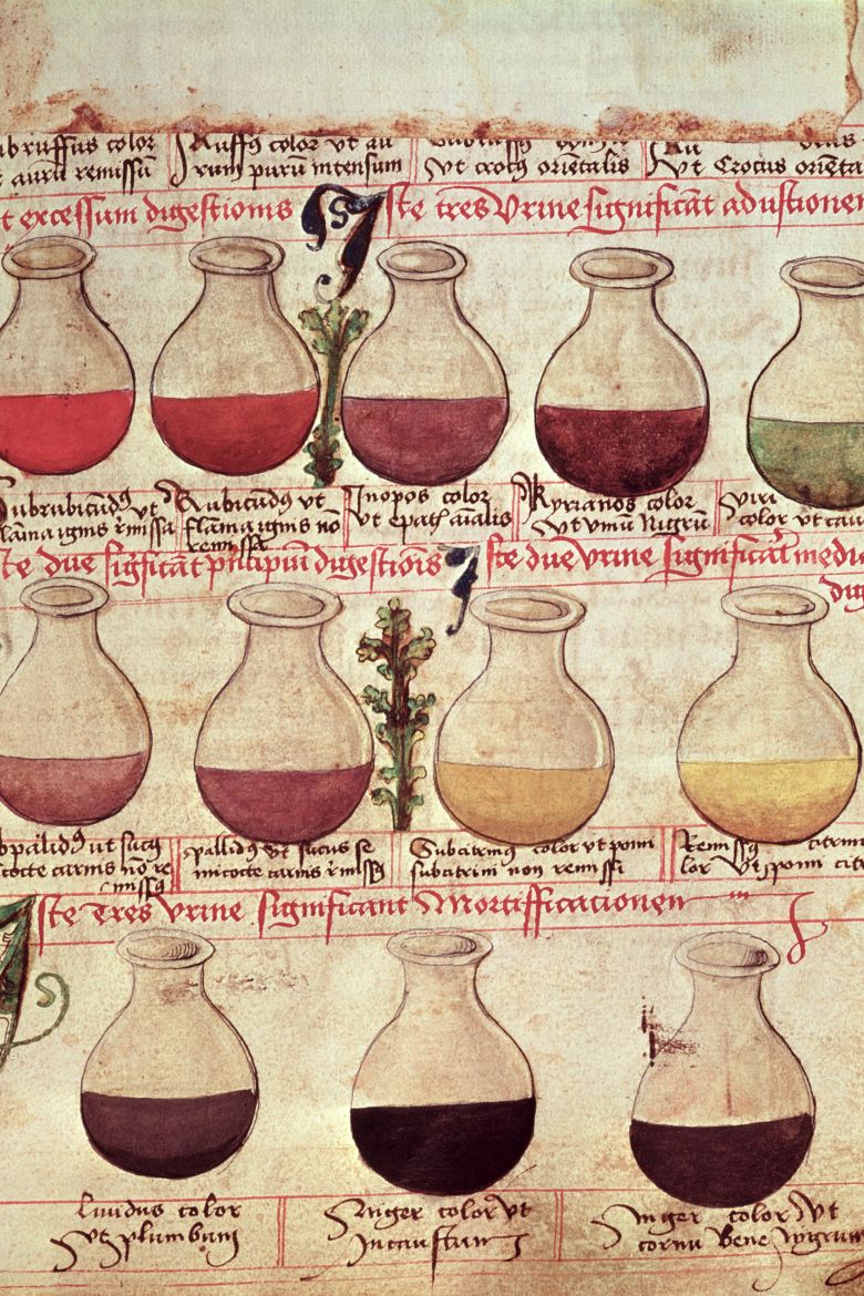 Urine analysis was one of the most popular tests used to diagnose medieval patients, even though doctors could tell very little about what was actually wrong with someone.