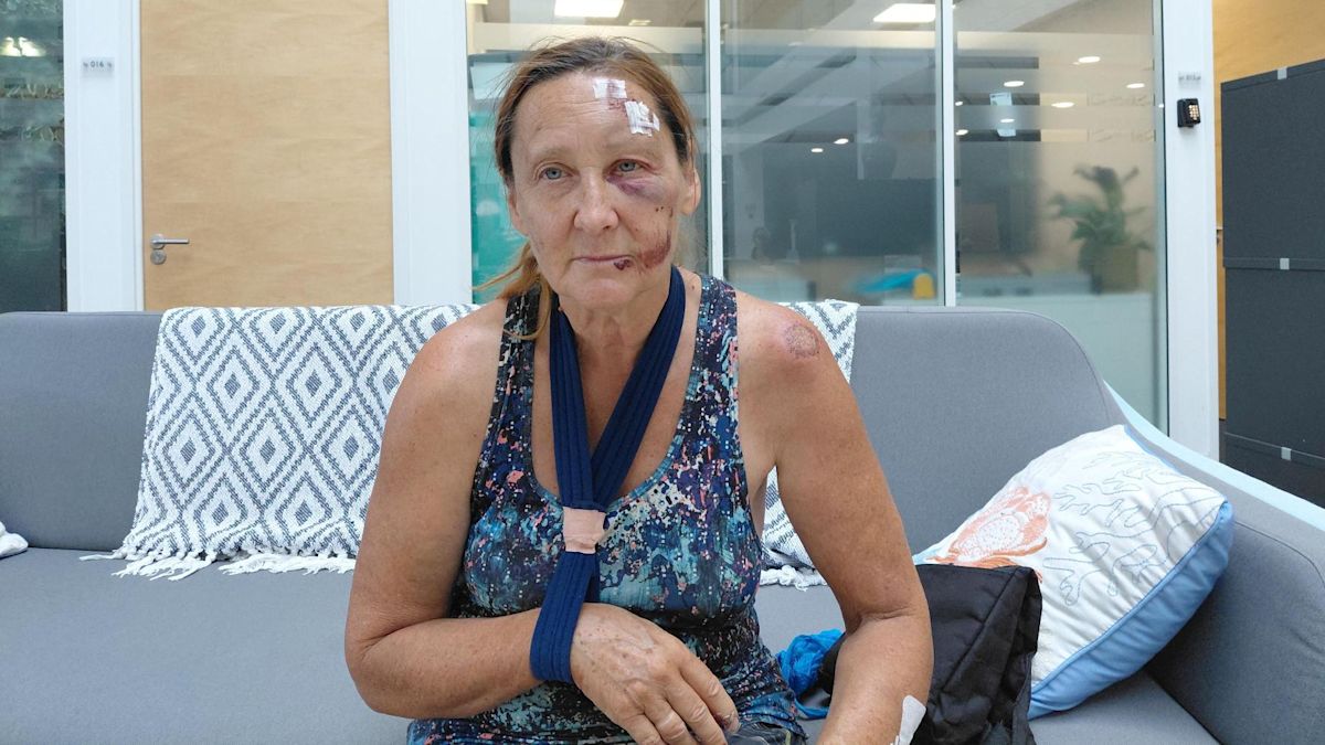 Cyclist hit by e-scooter left with serious injuries