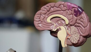 Dementia Tests May Miss Women For Years Longer Than Men