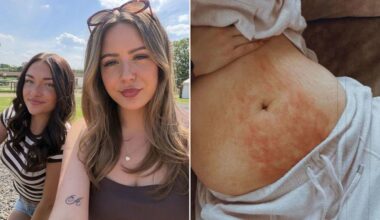 Sisters Both Get Diagnosed with Endometriosis After Doctors Dismissed Their Debilitating Pain as ‘Just Bad Periods’ for Years
