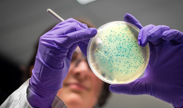 Salmonella outbreak in UK leaves one dead and hundreds ill