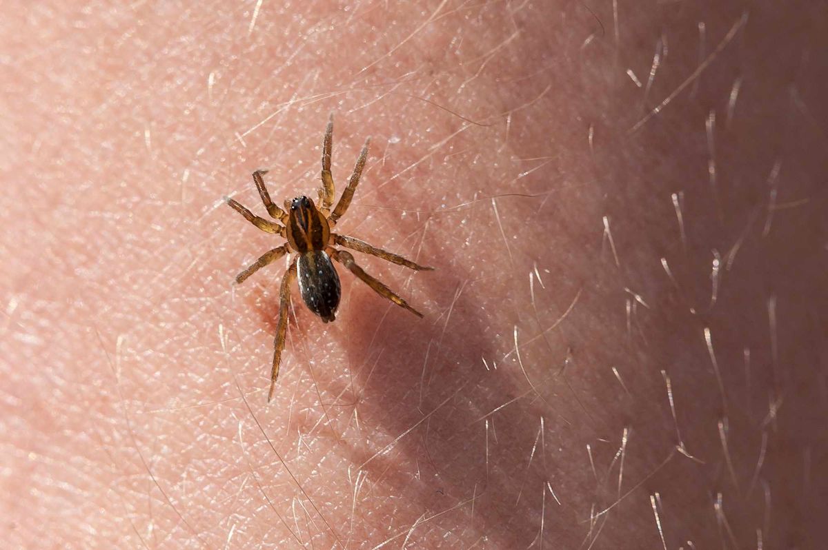 A Woman Was Bitten by Spiders on a Lakeside Family Trip—Nearly 3 Months Later, She’s Still Fighting for Her Health