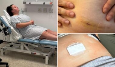 Docs removed two of my organs before figuring out what was wrong with me