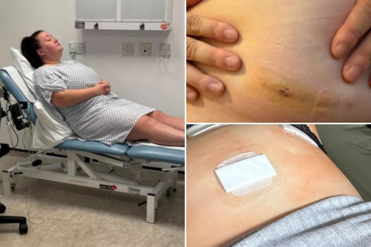 Docs removed two of my organs before figuring out what was wrong with me