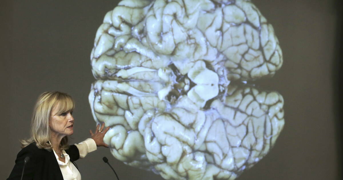 At least 1 in 4 NFL players who died in recent years had CTE, study finds