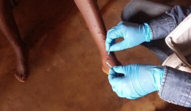 Africa: 11 African Countries Record 1,153 Mpox Cases in Six Weeks