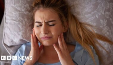 Some dentists say more young people are grinding their teeth