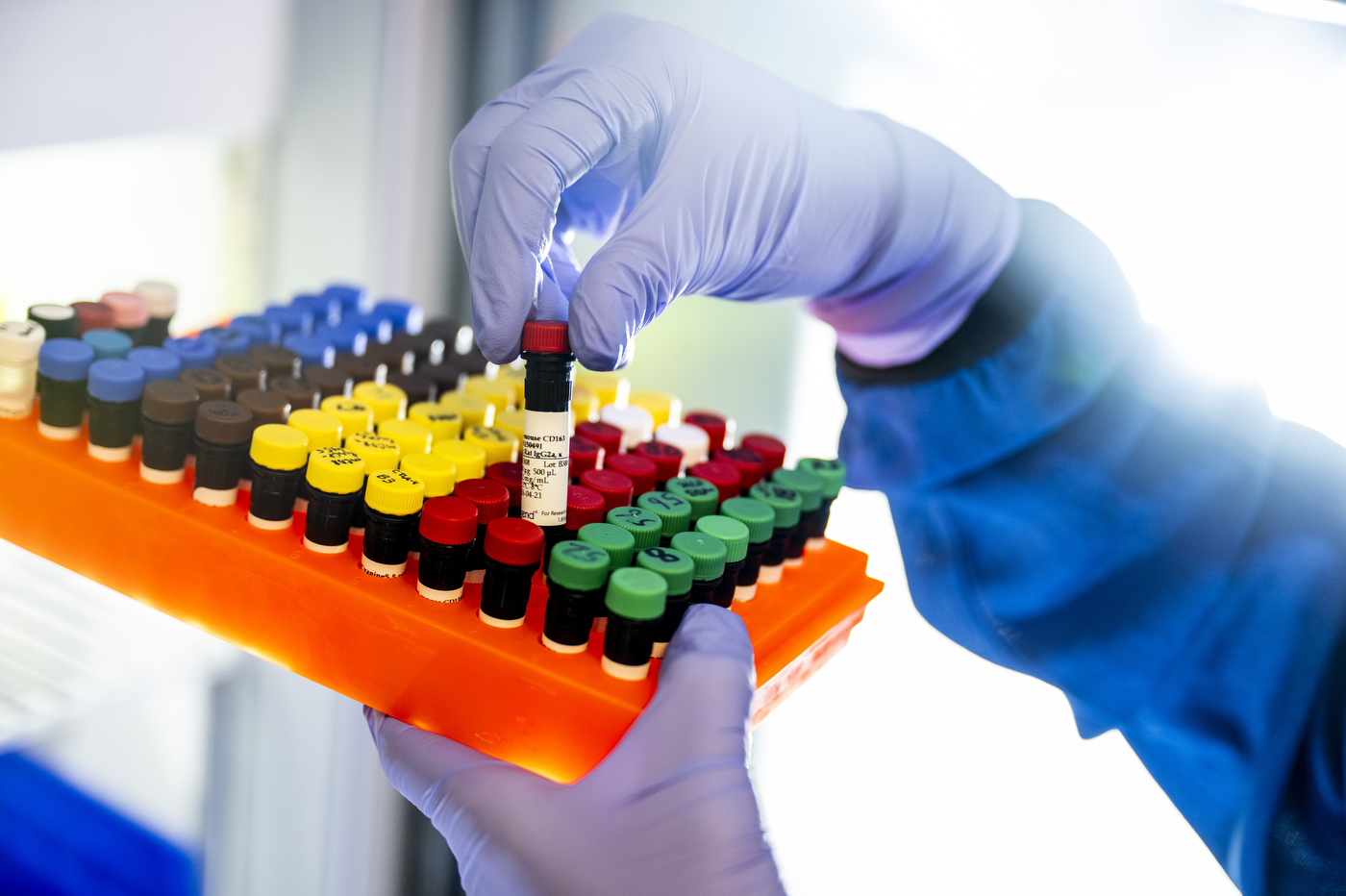 A gloved hand uses a pipette to draw liquid from a rack of color-coded vials.