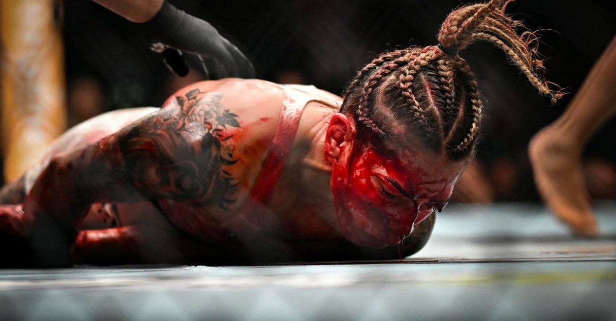 Sofia Montenegro Hospitalized After Bloody UFC Paris Loss