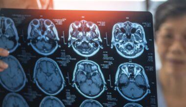 Older Americans have dementia without knowing—experts reveal signs to watch