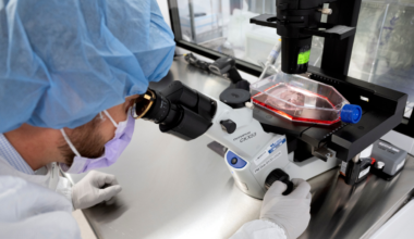 AI in healthcare advances melanoma treatment and drug repurposing
