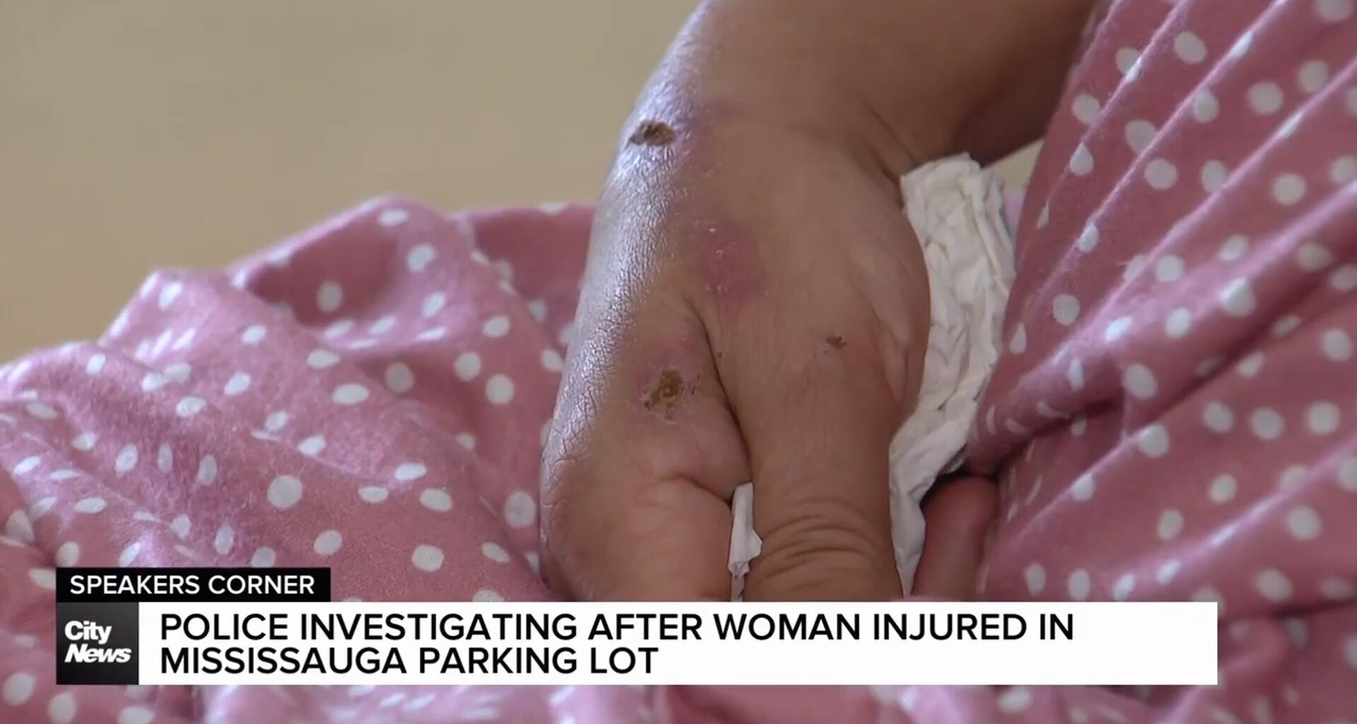 Police investigating after Mississauga woman injured in parking lot incident
