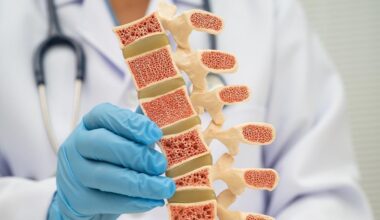 Cancer drug CADD522 shows bone-building and metabolic benefits in post-menopausal osteoporosis research