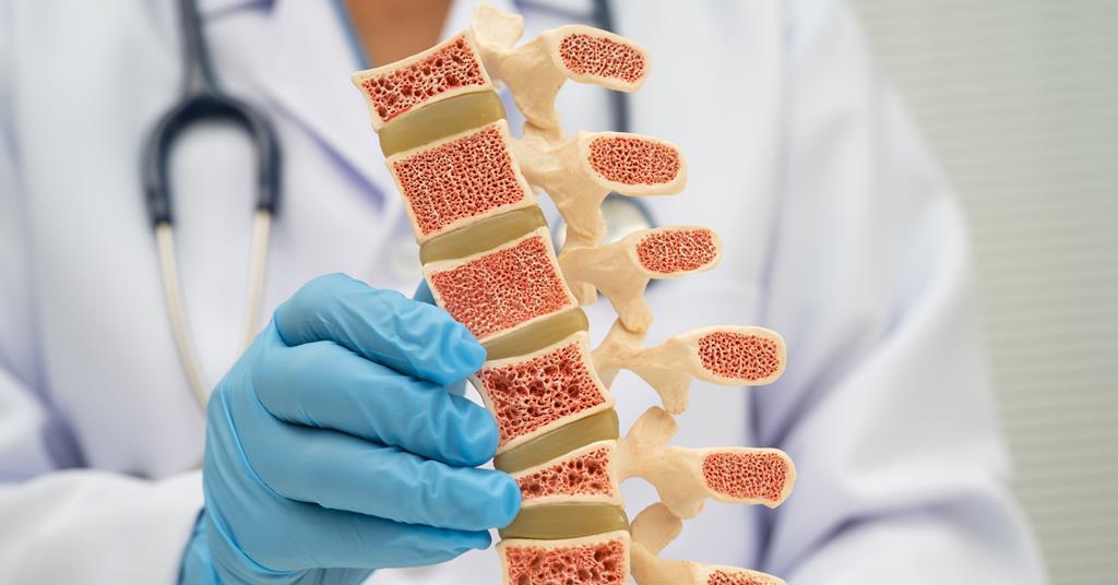 Cancer drug CADD522 shows bone-building and metabolic benefits in post-menopausal osteoporosis research