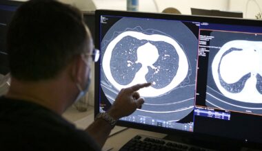 Newly approved pancreatic cancer drug shows promise in lung cancer - NBC News
