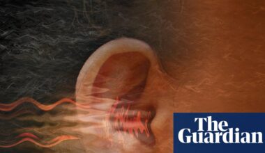 Living with tinnitus can be distressing. So what can you do about it? | Health & wellbeing