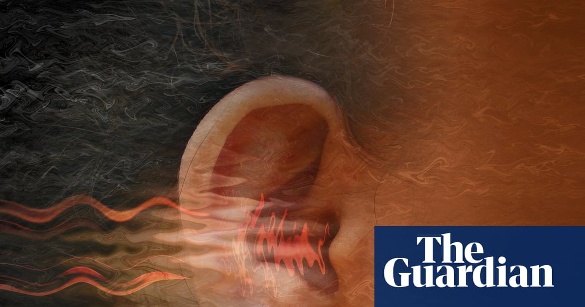 Living with tinnitus can be distressing. So what can you do about it? | Health & wellbeing