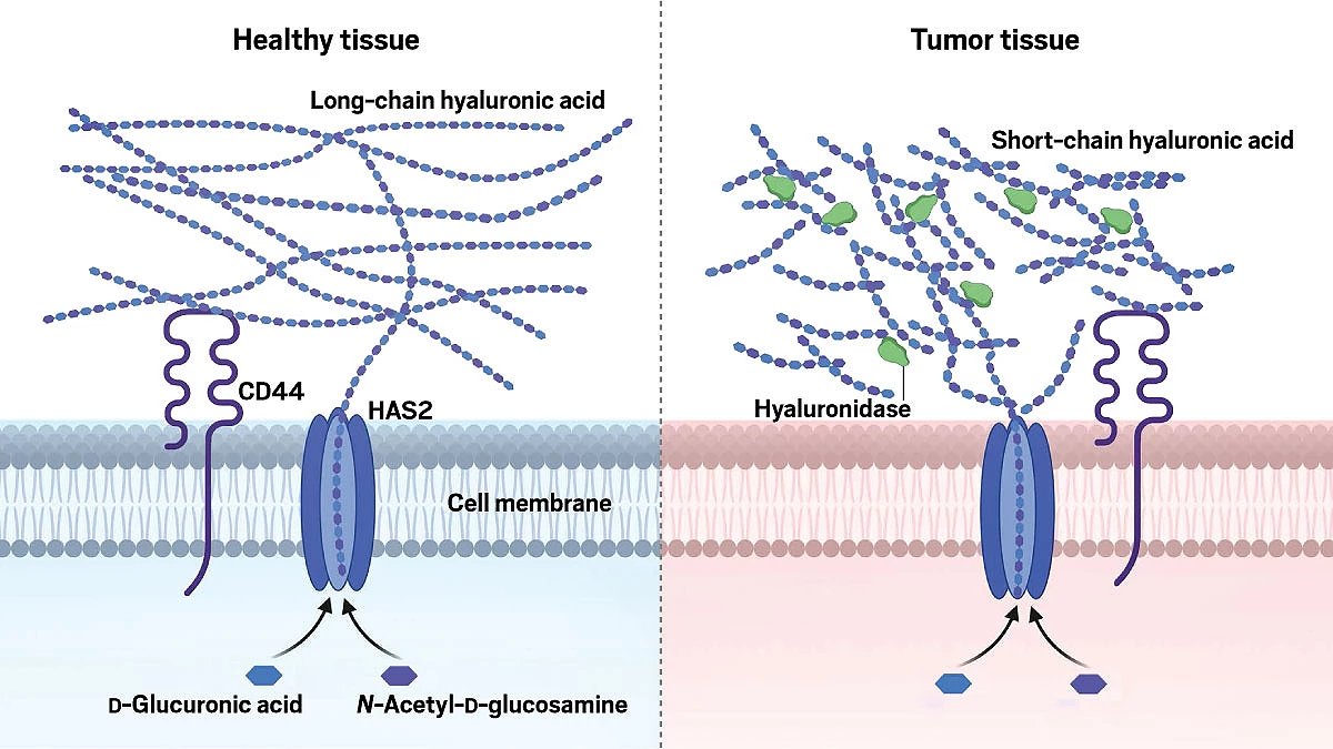 In healthy tissue, a HAS2 enzyme sitting in a cell membrane churns out long chains of hyaluronic acid stitched together from glucuronic acid and <i>N</i>-acetylglucosamine. A CD44 receptor binds but does not respond to the long chains. In tumor tissue, the HAS2 enzyme similarly churns out hyaluronic acid molecules, but the long chains are chopped by a large number of hyaluronidase enzymes. The chopped-up chains trigger the CD44 receptor.