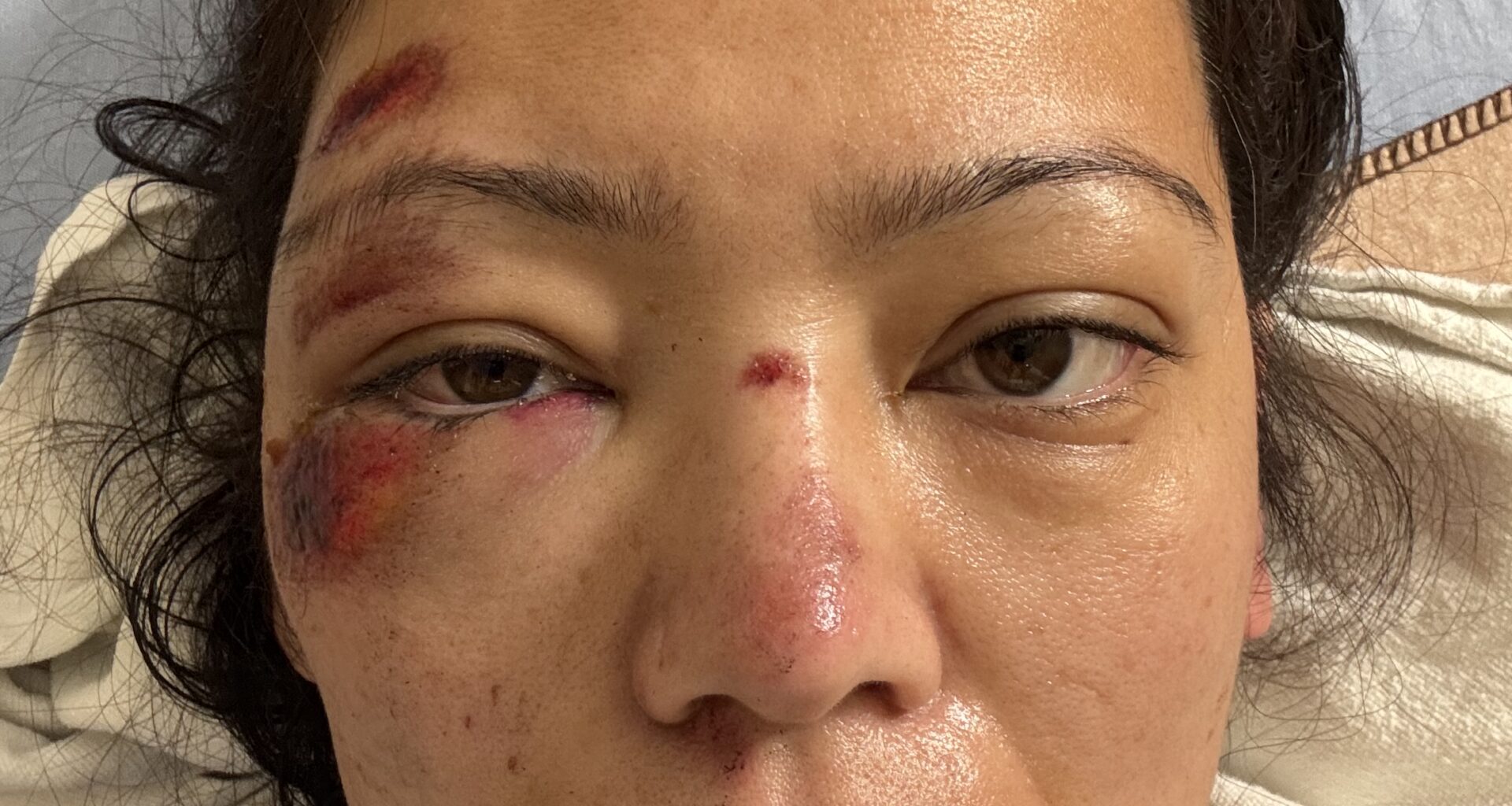 Parking lot incident sends Mississauga woman to hospital as investigation continues