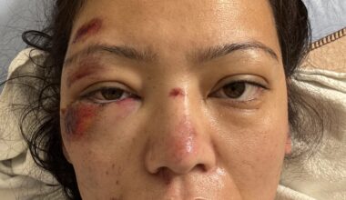 Parking lot incident sends Mississauga woman to hospital as investigation continues