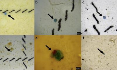 Researchers explore link between microplastics and lung cancer • healthcare-in-europe.com