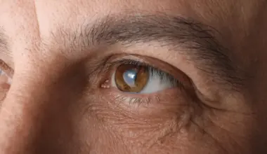 Cialis linked to higher glaucoma risk in large study