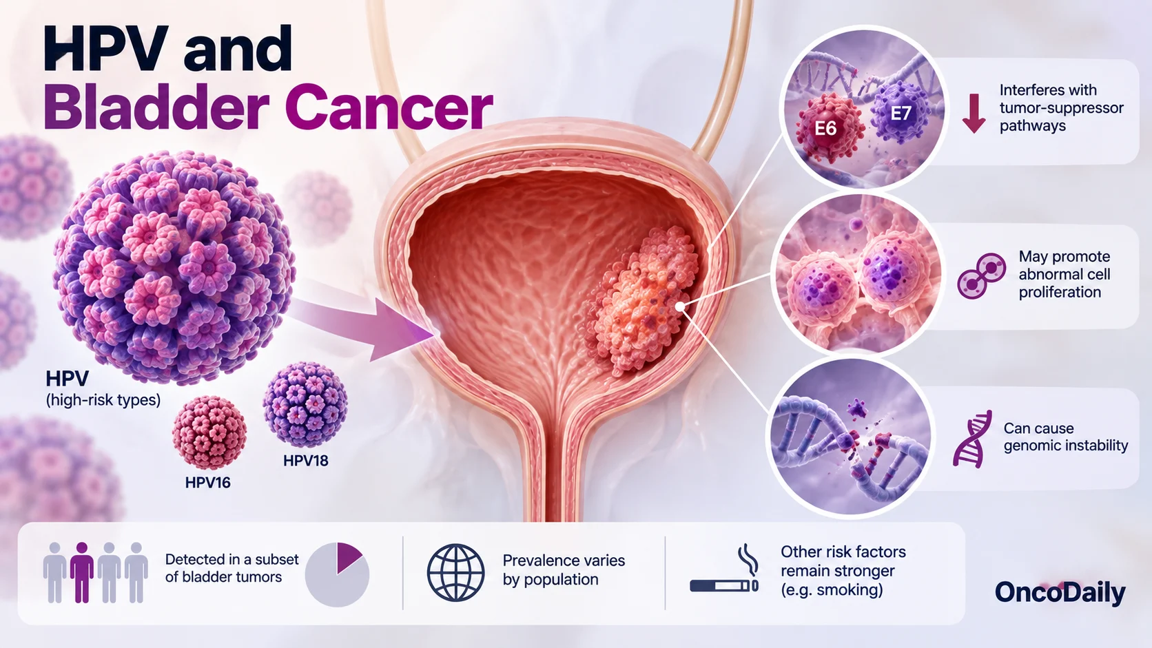 The Viral Side of Bladder Cancer: BK Polyomavirus, HPV, and Urothelial Carcinoma 4 The Viral Side of Bladder Cancer: BK Polyomavirus, HPV, and Urothelial Carcinoma