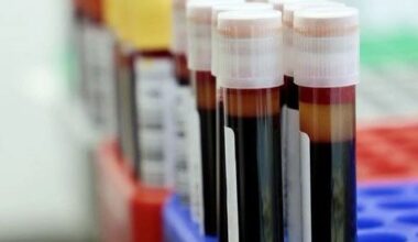 lab testing