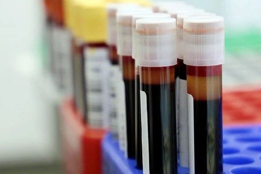lab testing