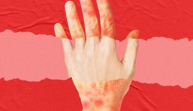 A New Anti-Aging Drug Looks to Turn Back the Clock on Skin Age