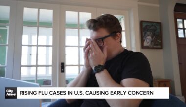 Rising flu cases in U.S. causing early concern