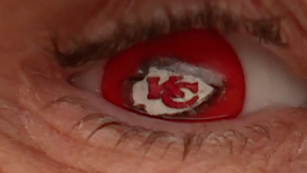 23006898 - KC Chiefs Eye. thumbnail.jpg